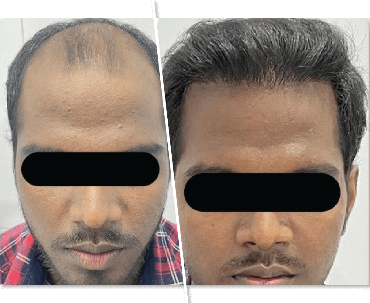 Men Before and After Hair Care Picture